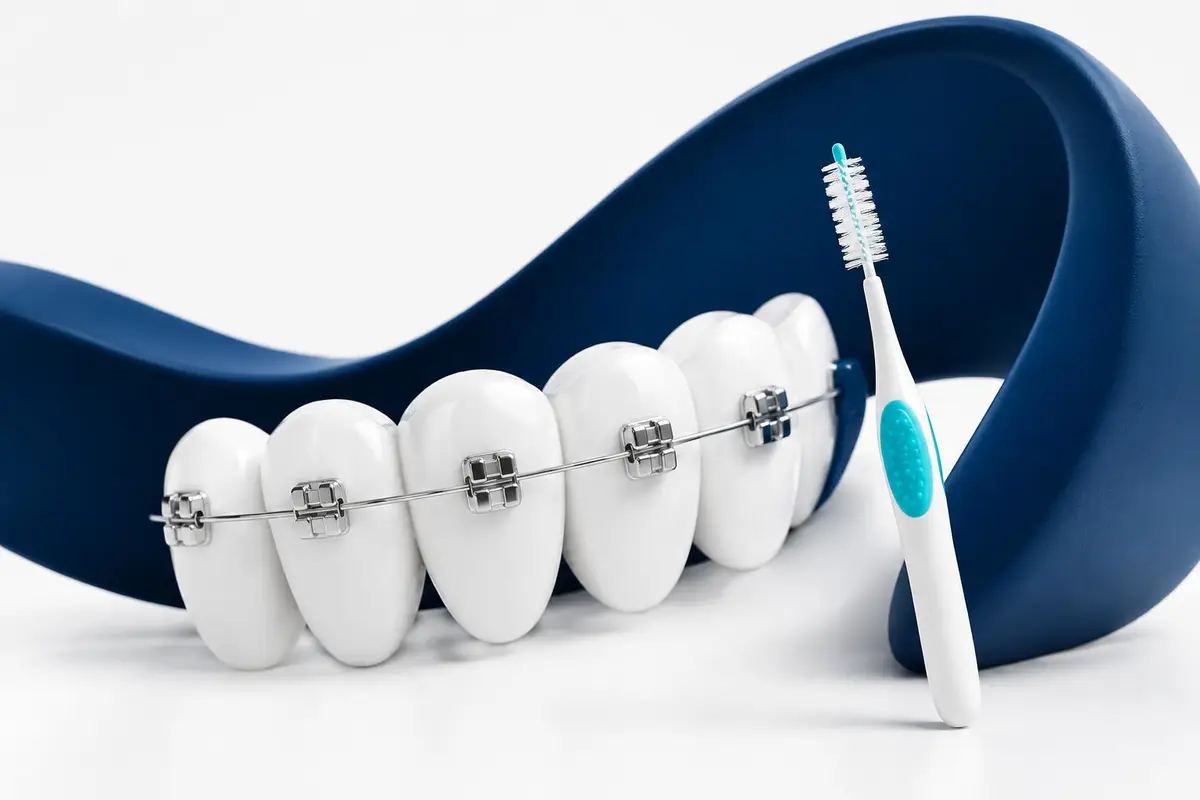 Rangée de dents 3D avec bagues (visuel existant de la page Orthodontie réutilisable)